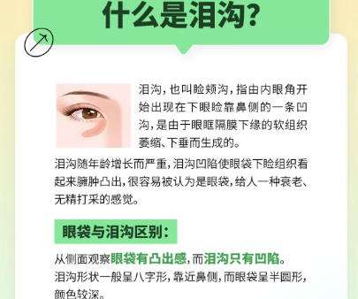 北医三院填充泪沟价格贵不贵？收费标准更新！