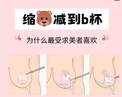 苏州缩胸手术多少钱？贵不贵？一般13,317元起