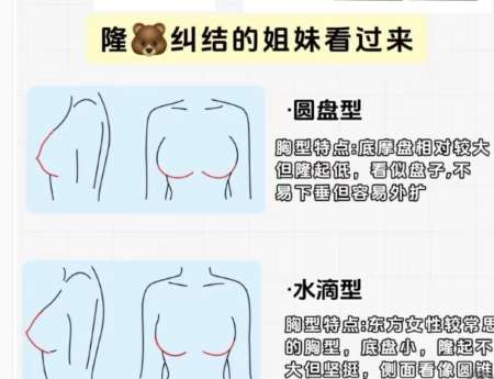 北京协和医院曾昂隆胸多少钱？脂肪隆胸2万6左右！含客户口碑