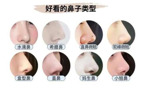 深圳王杰鼻子案例图展示！网友隆鼻流程分享！真实水平揭秘