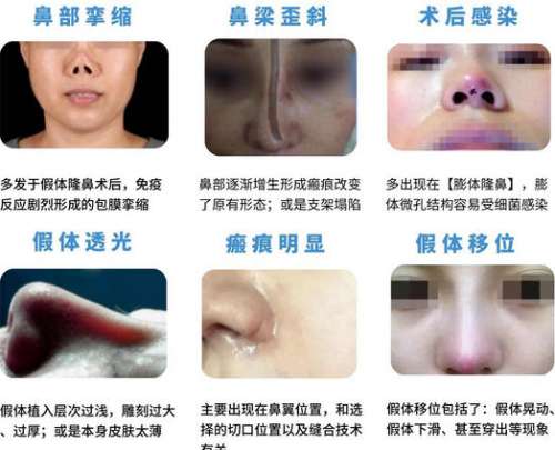 深圳王杰收费贵吗？宝丽鼻修复专家名单公布 ！医生基本信息公布