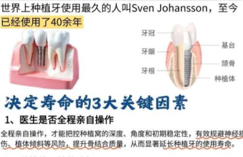 锦州种植牙多少钱一颗？价格在3k到1w期间不等有靠谱医院推荐！