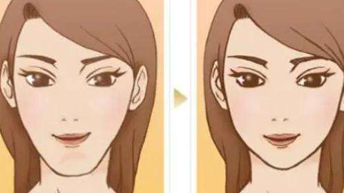 杭州垫下巴多少钱？美莱医疗、艺星、薇琳等都是性价比机构！