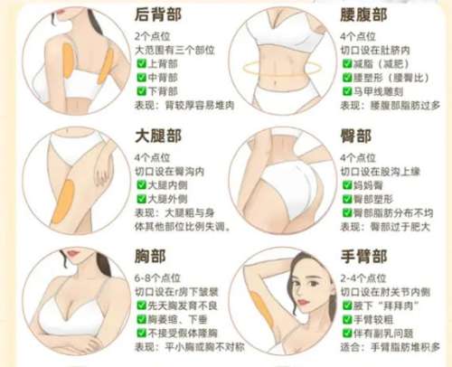 胡振富医生口碑如何？做吸脂、双眼皮真实反馈来了！审美时尚/手法细腻