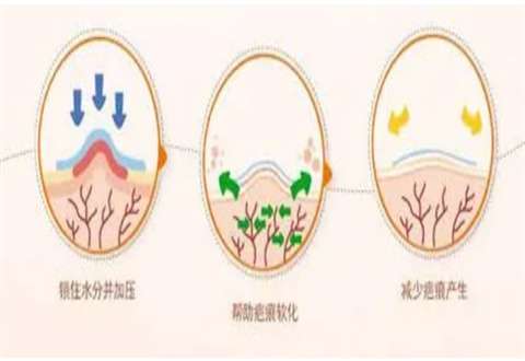 疤痕修复手术一般多少钱正规医院，次数怎么样？进入查看科普知识