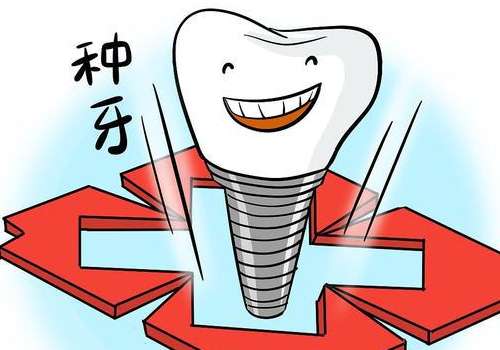 美国3i种植体型号有几个？是什么金属？多久恢复？