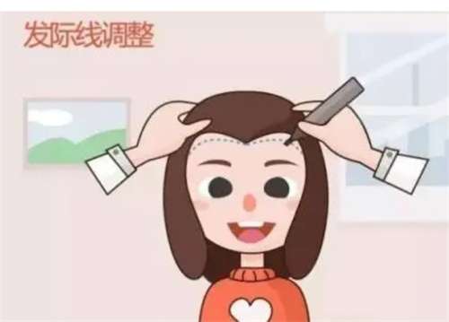 广州发植发多少钱？全貌解码头部美容项目费用