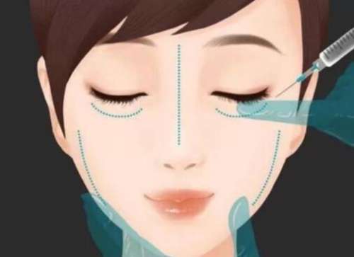 合肥市打玻尿酸多少钱一针