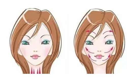 小拉皮手术多少钱？看拉皮技术优势