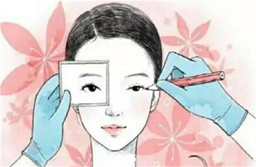 埋线双眼皮价格是多少？不开刀方法，值得了解