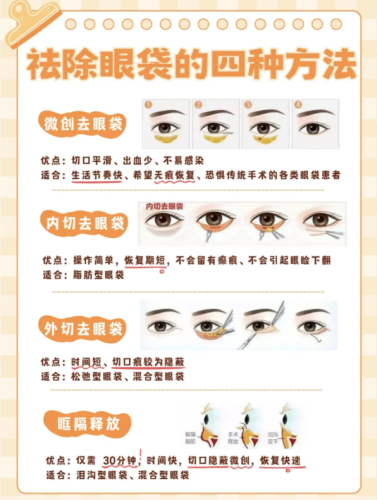 淮南做眼袋哪里专业？眼袋难题这样做更安心