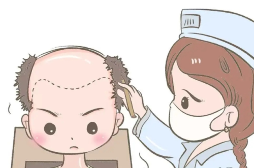 北京八大处医院植发效果怎么样？效果维持时间、返工率与患者口碑全盘点