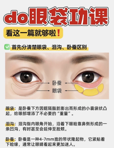 成都去眼袋哪个医院技术好？选对医院，年轻10岁