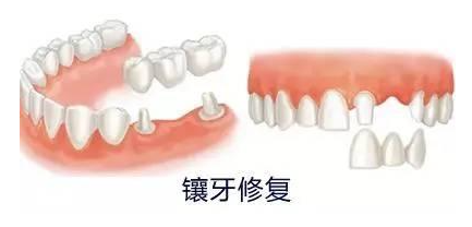 山东大学齐鲁医院口腔科种牙挂什么科？一文说清挂号流程+医生怎么选