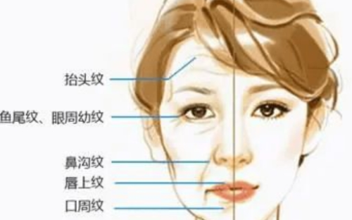 上海九医院除皱怎么样？不同除皱方式对比与维持时间解析