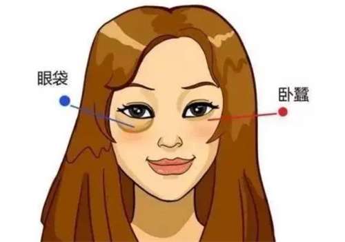 去眼袋整形手术价格贵吗？术后能维持多久？