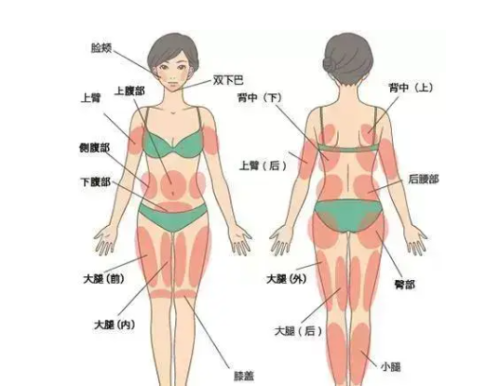 深圳吸脂专家有哪些？医生从业年限、案例数量及预约难度排行