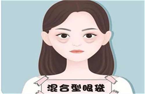 抽脂去眼袋手术多少钱？需要做几次？一并了解