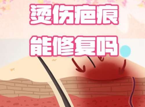 疤痕修复避坑指南：如何选择靠谱医院和医生？
