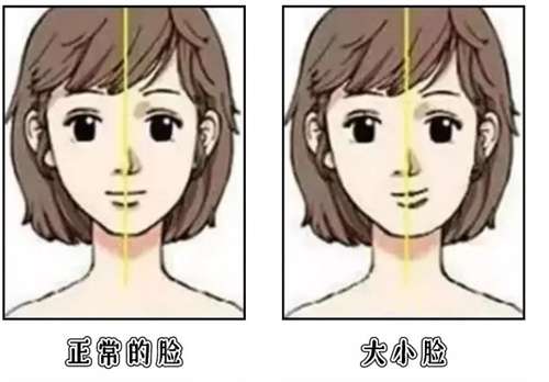 大小脸矫正手术很贵吗？大小脸矫正手术是做的越早越好吗？