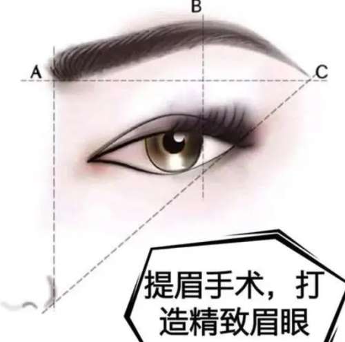 眉部整形要多少钱？