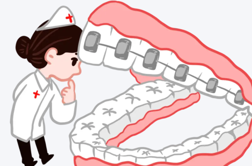 南方医科大学深圳医院正畸科攻略，正畸费用、流程和适合人群都在这