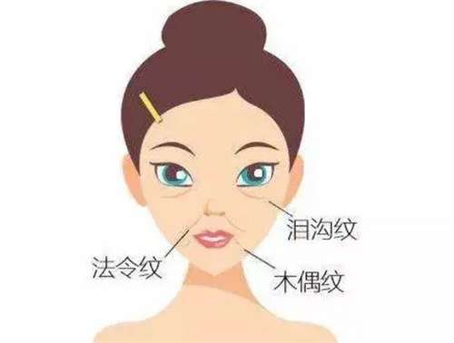 瑞蓝丽瑅玻尿酸售价是多少？价格公布带你了解