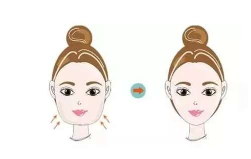 面部吸脂的价格多少