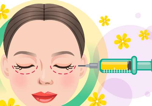 迈诺威溶脂针怎么用？效果如何？能维持多久？
