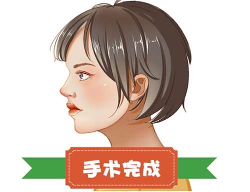 肋骨隆鼻价格贵吗？费用明细公布，点击