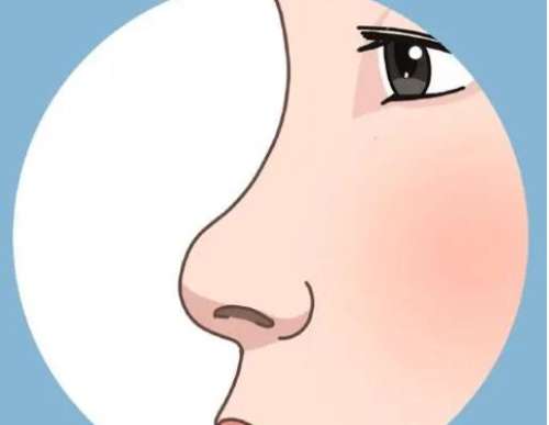成都玻尿酸隆鼻需要多少钱