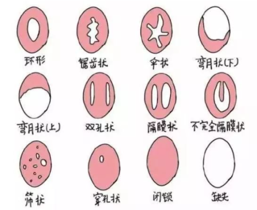 银川处女膜修复哪家靠谱？私密整形口碑医院闭眼选不踩坑