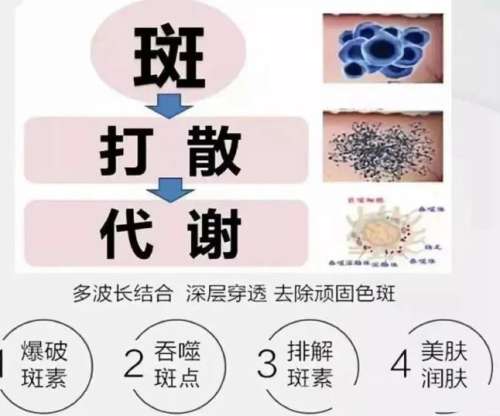 欧洲之星祛斑价格多少？“斑星人”不可错过的好物