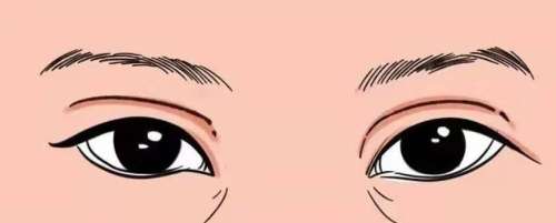 马娟双眼皮修复怎么样？在哪里坐诊？精选案例一览