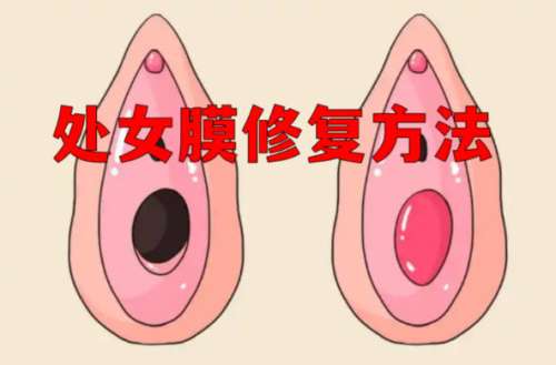 宁波私密处女膜修复术后多久恢复？正规医院隐私保护加价格明细