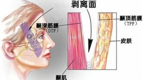 南京面部提升（拉皮）手术价格多少？2026年五大口碑医院盘点