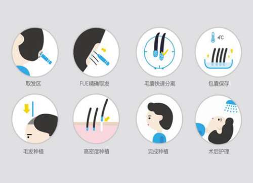 天津长征医院植发怎么样？毛发移植体验揭晓，靠谱选择看这里