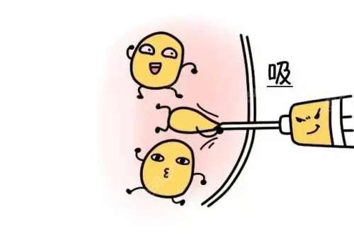 蝴蝶臂吸脂多久能恢复？因人而异，与体质、术后护理等有关系