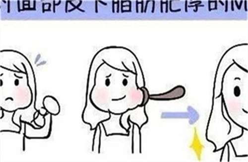 下巴抽脂肪一般多少钱？不超一万，打造精致下巴